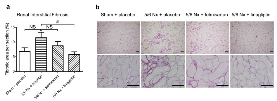  Kidney morphology. (a) Renal interstitial fibrosis, (b) typical photomicrographs of the kidneys stained with sirius red for interstitial fibrosis.