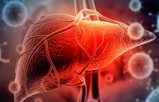 Liver Disease Models