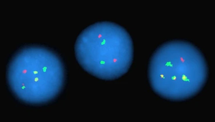 5-different-types-of-fish-probes-for-oncology-research-1