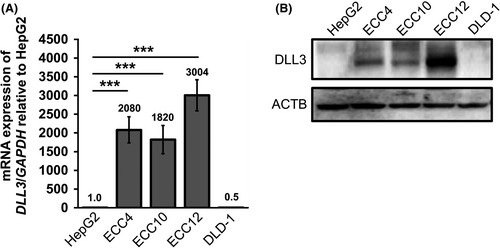 Expression levels of delta-like 3 (DLL3) in ECC cell lines derived from gastrointestinal-neuroendocrine carcinoma.