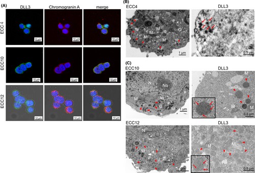 Morphological characteristics of DLL3 expression in gastrointestinal-neuroendocrine carcinoma ECC cell lines.