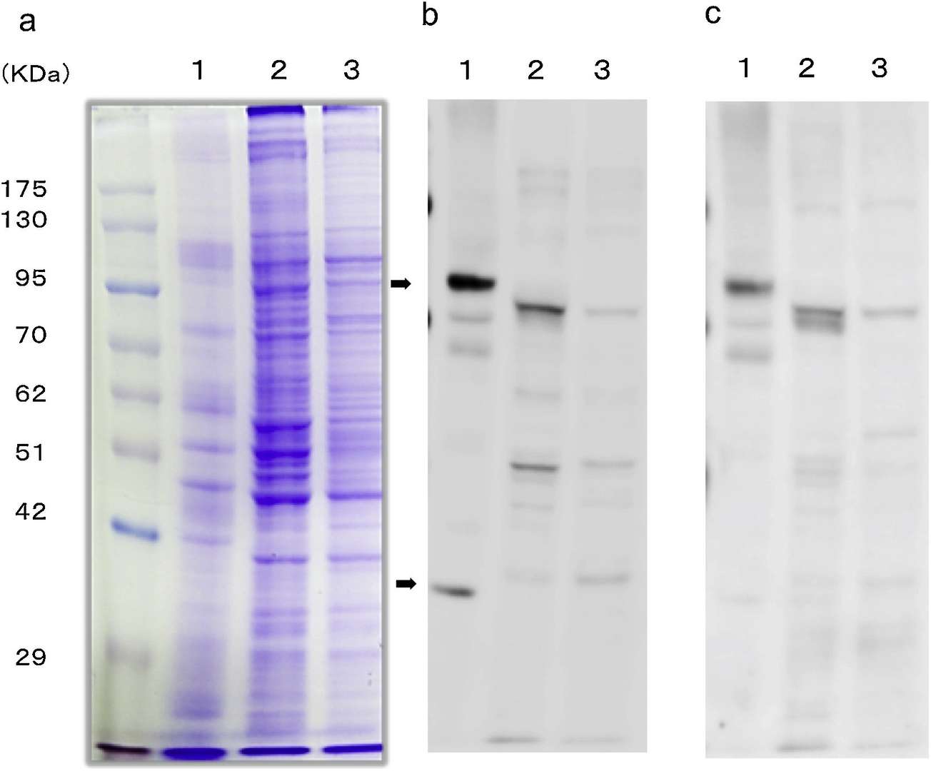Western blot analysis of mucin12 protein in both A. lumbricoides crude antigen and human gastrointestinal cells.