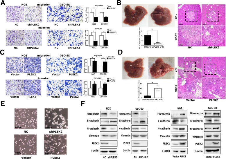 a, c Migration and invasion ability of NOZ and GBC-SD cells with stable PLEK2 knockdown (a) and PLEK2 overexpression (c) were measured by transwell migration and matrigel invasion assays. b, d Represent images of mouse livers of NOZ cells with stable PLEK2 knockdown (b) and PLEK2 overexpression (d) are shown and the numbers of metastatic nodes per liver were measured. e Morphological change of NOZ cells upon PLEK2 knockdown or overexpression. f Expression of epithelial marker E-cadherin, mesenchymal markers Fibronectin, Vimentin, and N-cadherin were detected by western blot.