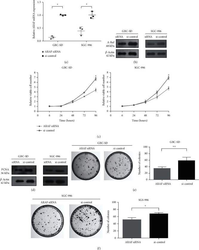 (a, b) RT-qPCR and western blot analysis were performed to confirm the effect of ARAF silencing. (c) Cell proliferation assays of ARAF silencing GBC cells. (d) Detection of the protein levels of PCNA in ARAF siRNA and siRNA control groups. (e, f) Knockdown of ARAF inhibited colony formation of both GBC cell lines.
