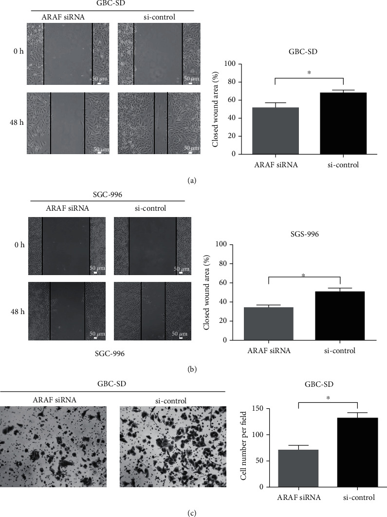 (a, b) Wound healing assays were utilized to identify the role of ARAF in migration. (c) Results of transwell assays of GBC-SD cells transfected with ARAF siRNA or siRNA control.