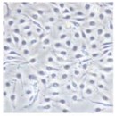 Human lung microvascular endothelial cells (HLMVECs).