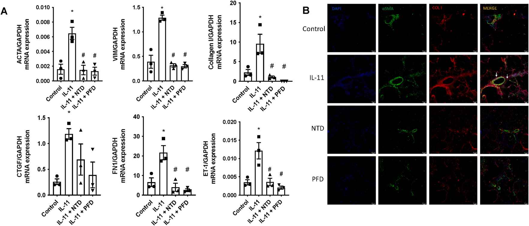 Nintedanib (NTD) and pirfenidone (PFD) inhibit the changes in vascular remodeling markers caused by IL-11 in precision-cut lung slices (PCLS).