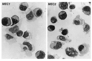SIRT1 and SIRT2 are overexpressed in CLL cell lines (JVM-3 and MEC-2).