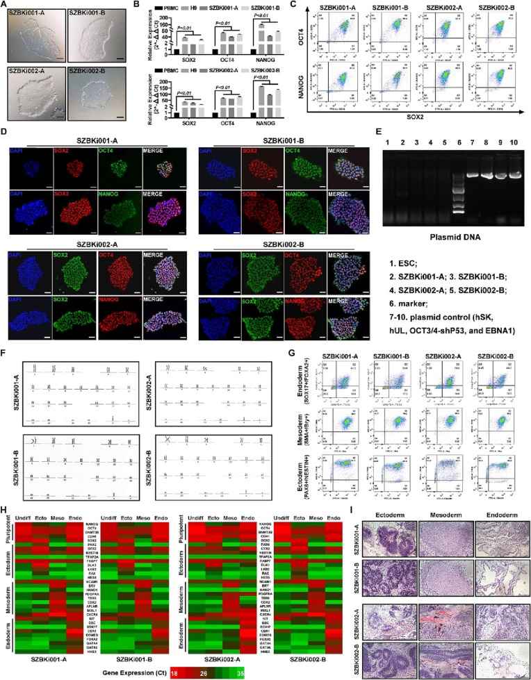 Characterization and validation of iPSC lines derived from PBMCs.