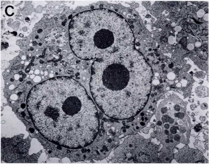 SUP-HD1 Cell Line Morphology.