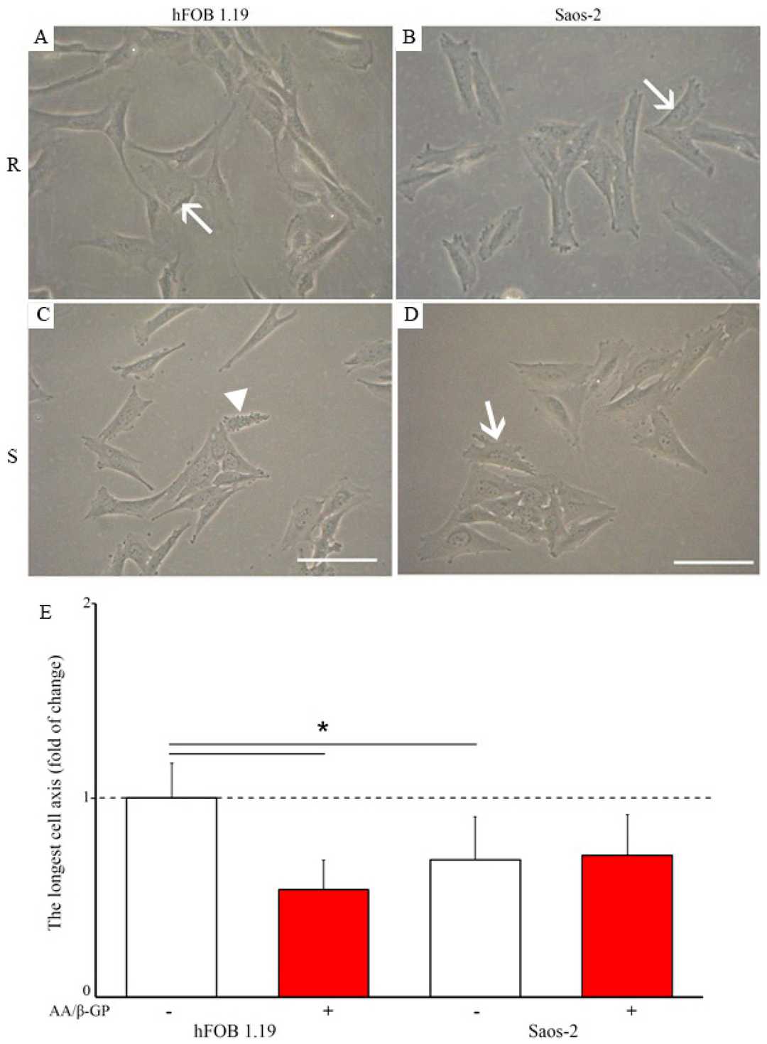 Morphology of hFOB 1.19 cells and Saos-2 cells under resting and stimulated conditions.