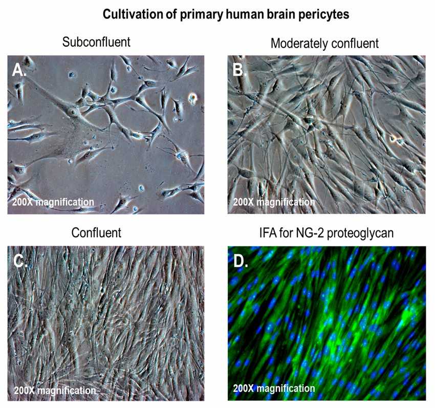 (A–C) Cultured primary human brain pericytes at varying confluency levels; (D) primary human brain pericytes stained with a monoclonal antibody for neural/glial antigen-2 (NG2) proteoglycan.