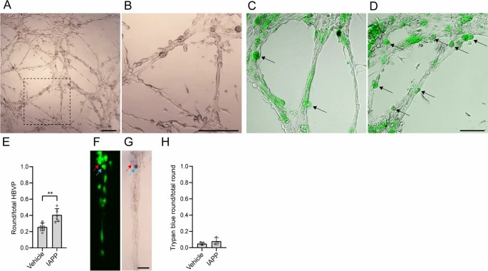 Impact of oIAPP on HBVP within the microvascular model.