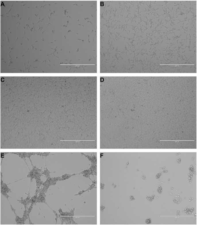 Images depict NCTC-2472 fibrosarcoma cells at various levels of confluency: 20% (a), 50% (b), 80% (c), and 100% (d). Once confluency exceeds 100%, cells aggregate into large, multicellular strands (e). Although NCTC-2472 cells are robust, nutrient depletion leads to poor cell health, characterized by shrinkage, blebbing, and loss of adherence (f).