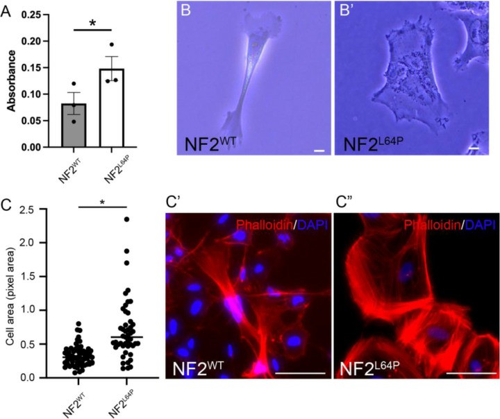 NF2L64P-derived Schwann cells exhibit abnormal phenotypes.