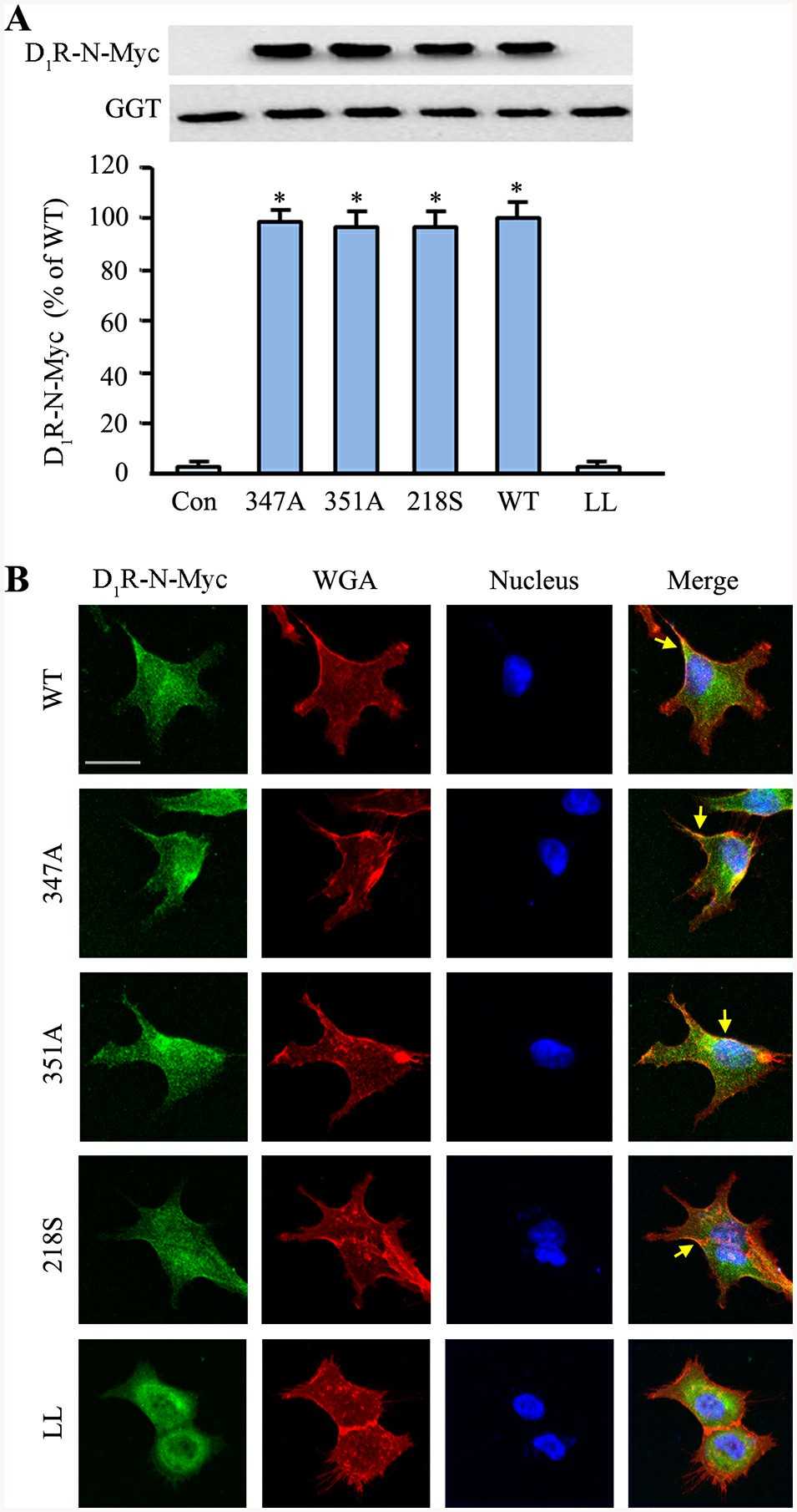 D1R mutants localize to the plasma membrane but fail to associate with lipid rafts.
