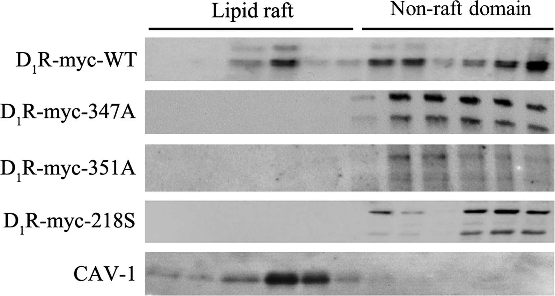 Distribution of D1R-WT and its mutants within lipid rafts.
