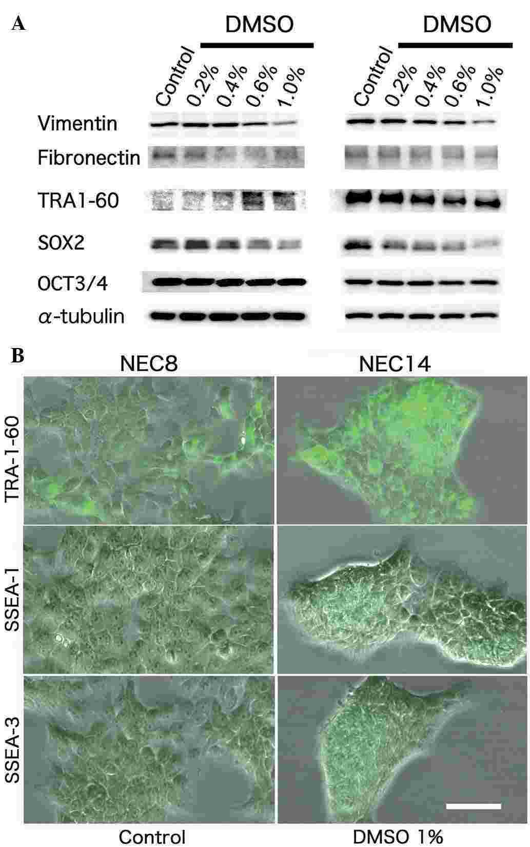 DMSO perturbs differentiation and reduces the stemness characteristics of human embryonic carcinoma cells.