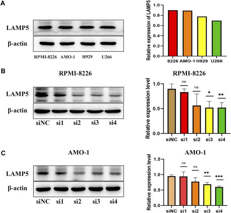 Expression of LAMP5 in MM cell lines (RPMI-8226, AMO-1, H929, and U266) and screening of siRNA for knockdown of LAMP5. (Chen Y and Ma T, 2023)