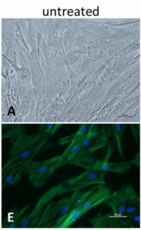 Human osteoblast cell morphology: (A) Phase contrast microscopy image (scale bar: 20 µm); (E) Fluorescence staining showing actin filaments and cell nuclei (scale bar: 50 µm).