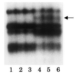 Fig. 2 Mutation of the C/EBPα gene in the patient sample and Kasumi-6 cell line. (Asou H, et al., 2003)