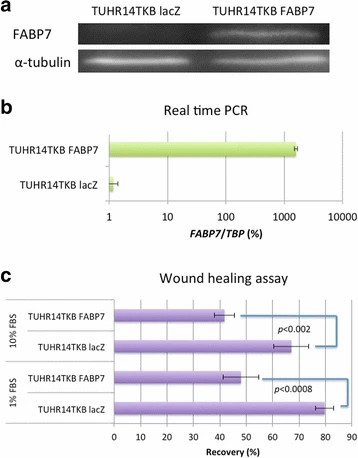 FABP7 influences the migration of TUHR14TKB cells.