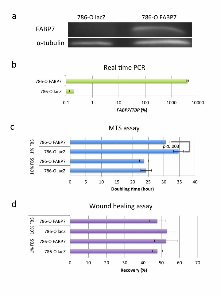 FABP7 overexpression affects the 786-O cell line.