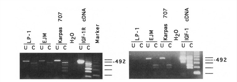 Expression of IGF-IR (left) and IGF-I (right) mRNA in LP-1, EJM, and Karpas 707. (Georgii-Hemming P, et al., 1996)