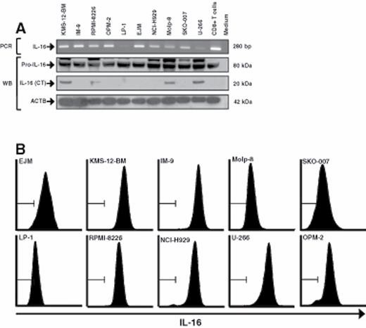 IL-16 expression in myeloma cell lines EJM and KMS-12-BM. (Atanackovic D, et al., 2012)