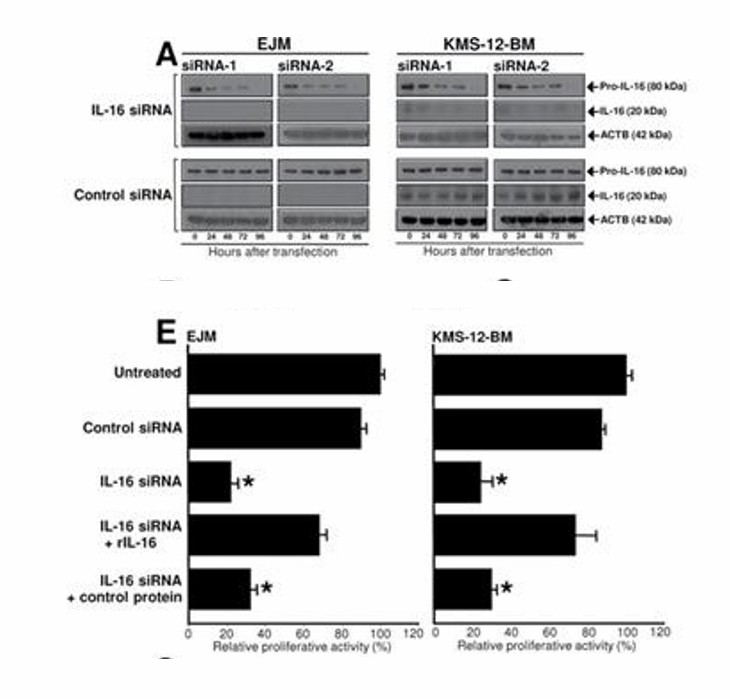 Functional consequences of IL-16 expression in myeloma cell lines, EJM and KMS-12-BM. (Atanackovic D, et al., 2012)