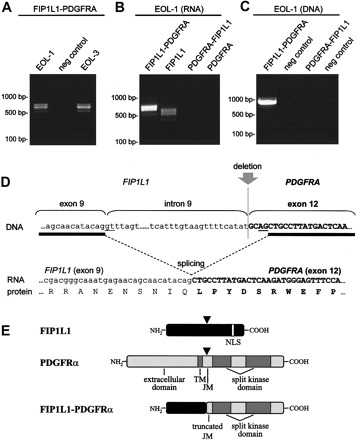 Detection of the FIP1L1-PDGFRA fusion transcript in the EoL-1 and EoL-3 cell lines (A), detection of FIP1L1 expression in the EoL-1 cell line (B), and amplification of the FIP1L1-PDGFRA fusion gene on DNA from the EoL-1 cell line (C).