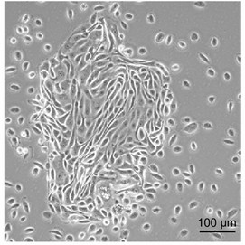 Primary renal proximal tubular epithelial cells.