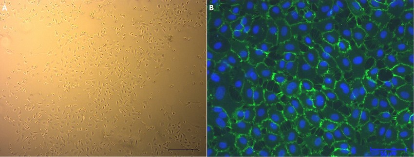 Cultured human umbilical vein endothelial cells (HUVECs): (A) Phase-contrast microscopy image. (B) Displaying cell surface marker CD31 in green.