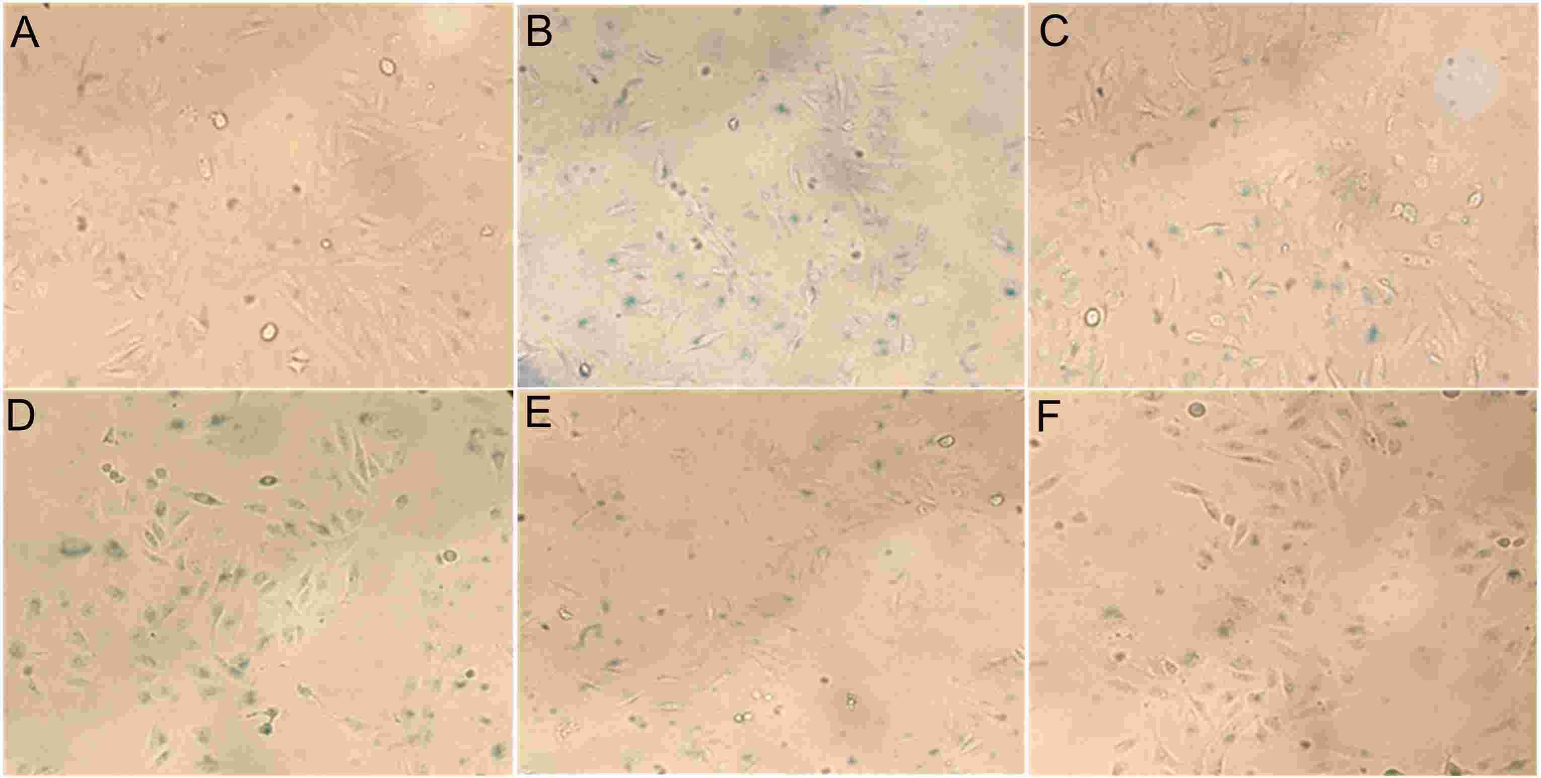 Morphological analysis of HUVECs: (A) Control group, (B) Model group, (C) Positive Control, and sample treatments at concentrations of compound 13 at 1 (D), 5 (E), and 50 (F) μg/mL.