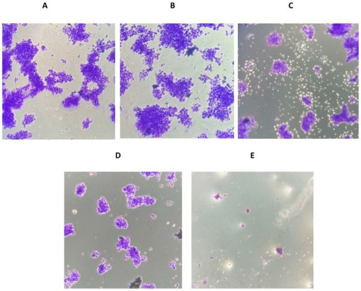 (A) control group 1 (no treatment), (B) control group 2 (treated with PBS), (C) treated with magnolol, (D) treated with cisplatin, (E) treated with magnolol and cisplatin.