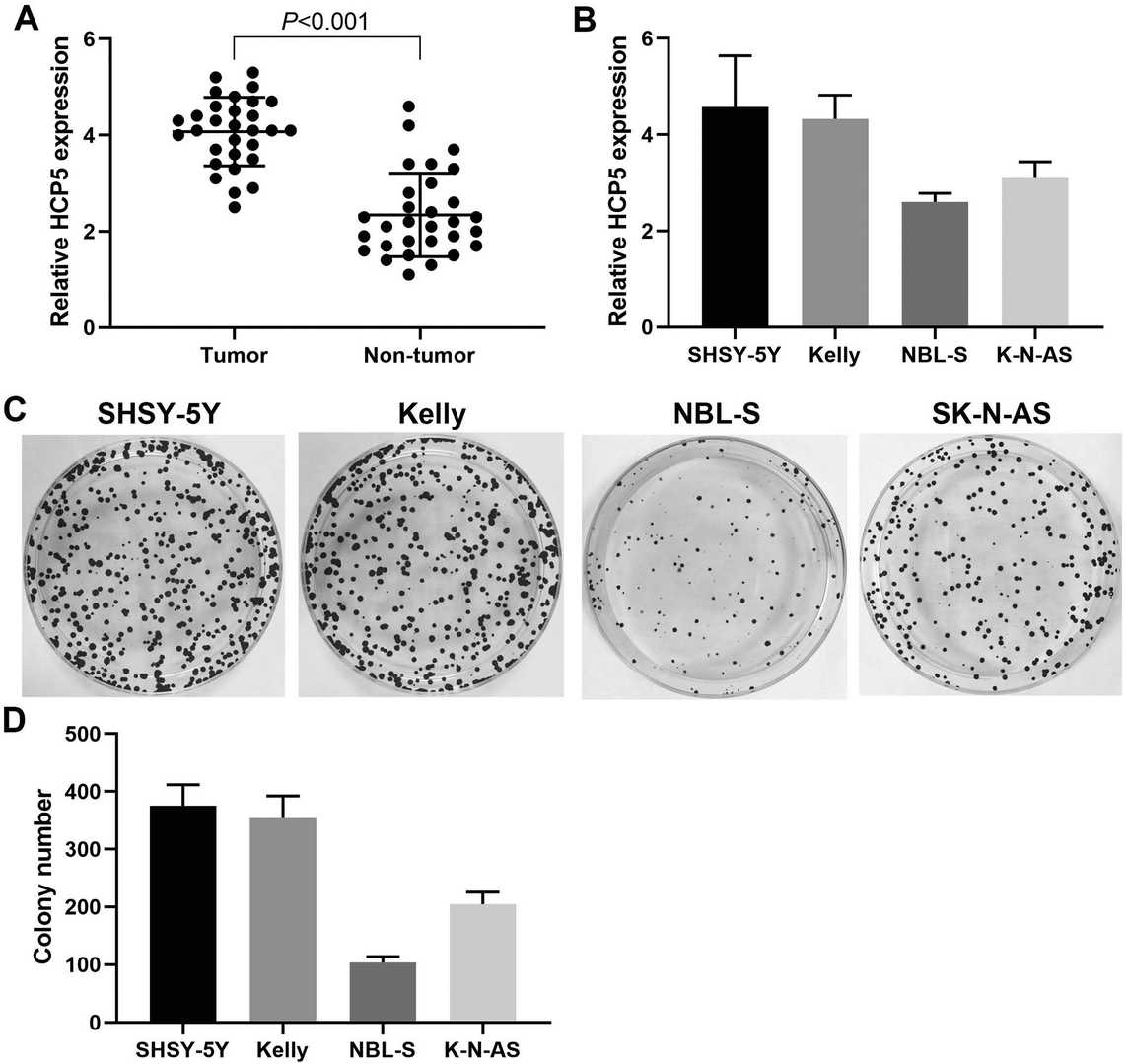The expression level of HCP5 in neuroblastoma was elevated and linked to increased cell proliferation. 