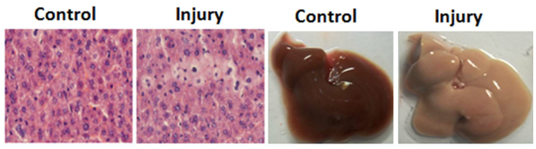 Acute Liver Injury Models