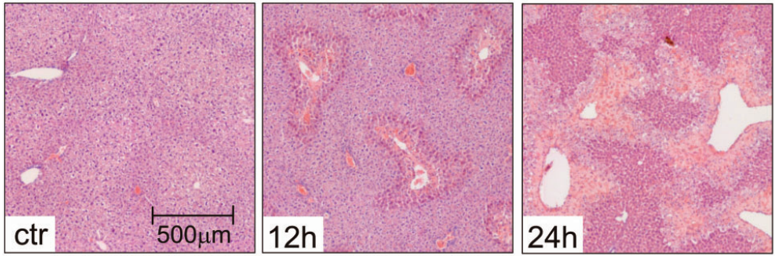 Acute Liver Injury Models