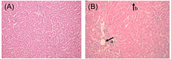 Acute Liver Injury Models