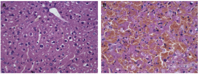 Acute Liver Injury Models