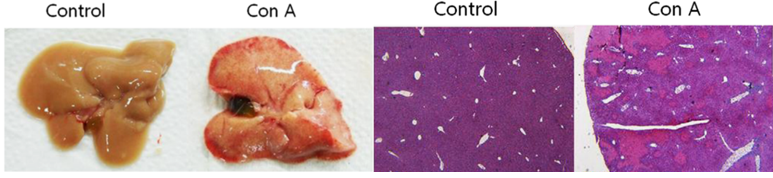 Acute Liver Injury Models