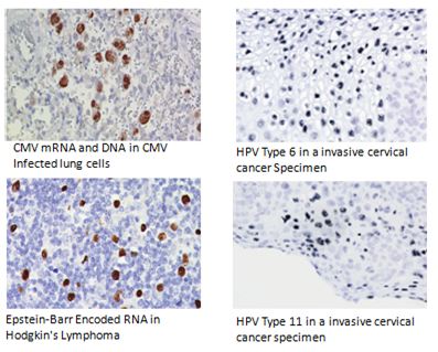 In Situ Detection of Virus