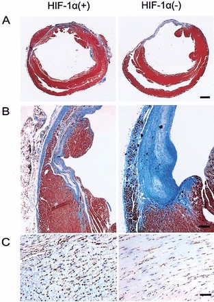 Cardiovascular Disease Models