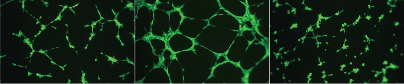 Cell Angiogenesis Assays