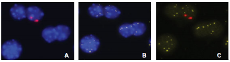 Cell Transplantation Analysis (FISH)