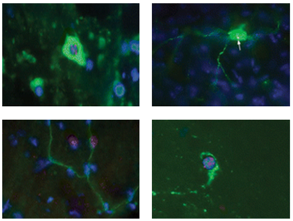 Cell Transplantation Analysis (FISH)