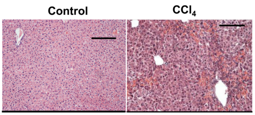 Chronic Liver Injury Models