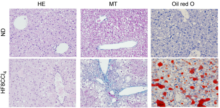 Chronic Liver Injury Models