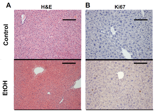 Chronic Liver Injury Models