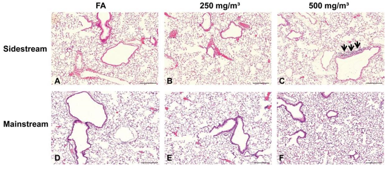 Chronic obstructive pulmonary disease (COPD) Models